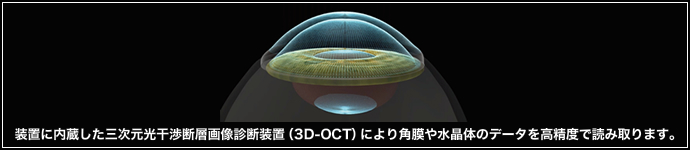装置に内蔵した三次元光干渉断層画像診断装置（3D-OCT）により角膜や水晶体のデータを高精度で読み取ります。